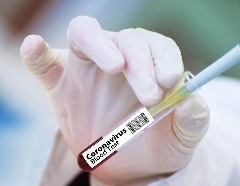 Ceará já realizou mais de 5 mil exames para COVID-19. Quase 2 mil ainda aguardam resultado